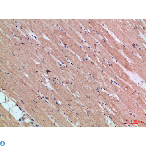 CYGB / Cytoglobin Antibody - Immunohistochemical analysis of paraffin-embedded Human-skeletal-muscle, antibody was diluted at 1:100.