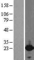CYGB / Cytoglobin Protein - Western validation with an anti-DDK antibody * L: Control HEK293 lysate R: Over-expression lysate