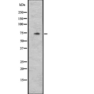 CYLC1 Antibody - Western blot analysis of CYLC1 expression in HeLa cells lysate. The lane on the left is treated with the antigen-specific peptide.
