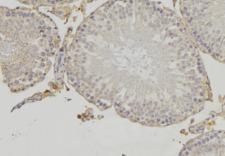 CYLC1 Antibody - 1:100 staining rat testis tissue by IHC-P. The sample was formaldehyde fixed and a heat mediated antigen retrieval step in citrate buffer was performed. The sample was then blocked and incubated with the antibody for 1.5 hours at 22°C. An HRP conjugated goat anti-rabbit antibody was used as the secondary.