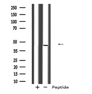 CYLC2 Antibody - Western blot analysis of CYLC2 expression in A431 whole cells lysate. The lane on the left is treated with the antigen-specific peptide.