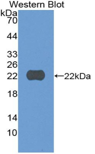 CYLD Antibody - Western blot of recombinant CYLD.
