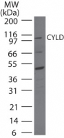 CYLD Antibody - Western blot of CYLD in HeLa cell lysate using antibody at 2 ug/ml.