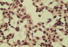 CYLD Antibody - ICC staining of HeLa cell using antibody (CYLD) at 5 ug/ml.
