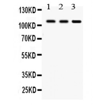 CYLD Antibody - CYLD antibody Western blot. All lanes: Anti CYLD at 0.5 ug/ml. Lane 1: Rat Testis Tissue Lysate at 50 ug. Lane 2: Rat Brain Tissue Lysate at 50 ug. Lane 3: HELA Whole Cell Lysate at 40 ug. Predicted band size: 107 kD. Observed band size: 107 kD.