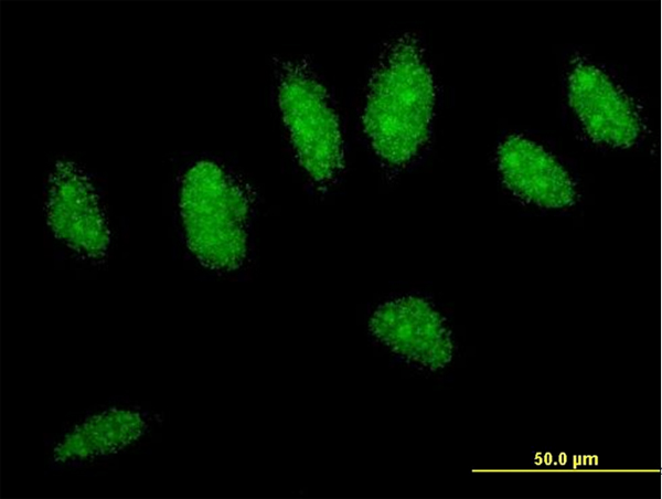 CYLD Antibody - Immunofluorescence of monoclonal antibody to CYLD on HeLa cell . [antibody concentration 10 ug/ml]