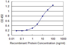 CYLD Antibody - Detection limit for recombinant GST tagged CYLD is 0.1 ng/ml as a capture antibody.