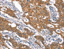 CYLD Antibody - Immunohistochemistry of paraffin-embedded Human brain using CYLD Polyclonal Antibody at dilution of 1:35.