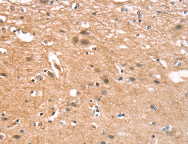 CYLD Antibody - Immunohistochemistry of paraffin-embedded Human brain using CYLD Polyclonal Antibody at dilution of 1:35.