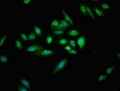 CYLD Antibody - Immunofluorescent analysis of Hela cells at a dilution of 1:100 and Alexa Fluor 488-congugated AffiniPure Goat Anti-Rabbit IgG(H+L)