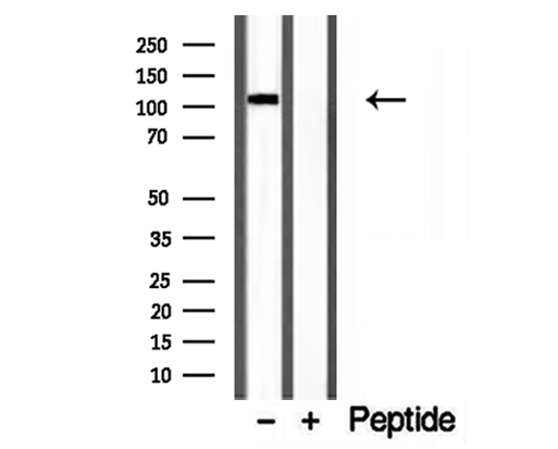 CYLD Antibody - Western blot analysis of extracts of HEK293 cells using CYLD antibody.