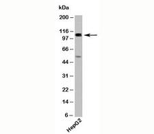 CYLD Antibody - CYLD antibody western blot with human samples