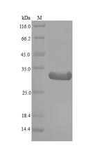 PRO1 Protein - (Tris-Glycine gel) Discontinuous SDS-PAGE (reduced) with 5% enrichment gel and 15% separation gel.