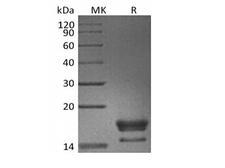 ANGPTL4 Protein - Recombinant Cynomolgus GITR Ligand/TNFSF18 (C-6His)