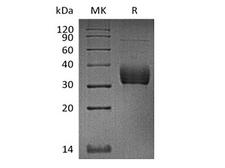 ANGPTL4 Protein - Recombinant Cynomolgus Sialic acid-binding Ig-like lectin 15/Siglec-15/CD33L3 (C-6His)