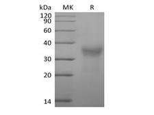 CD7 Protein - Recombinant Cynomolgus CD7/Leu-9 (C-6His)