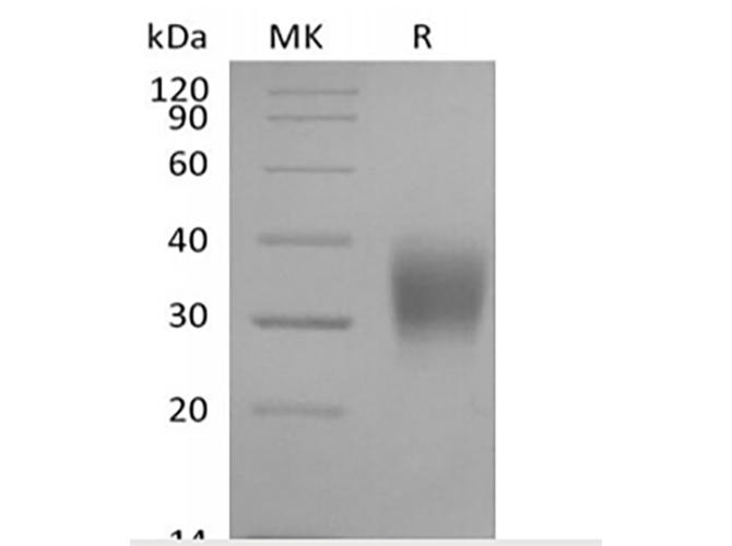 FCGR3A / CD16A Protein - Recombinant Cynomolgus Fc gamma RIIIA/FCGR3A/CD16a (C-6His)