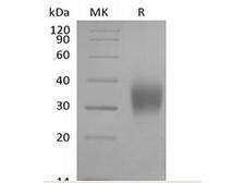 FCGR3A / CD16A Protein - Recombinant Cynomolgus Fc gamma RIIIA/FCGR3A/CD16a (C-6His)