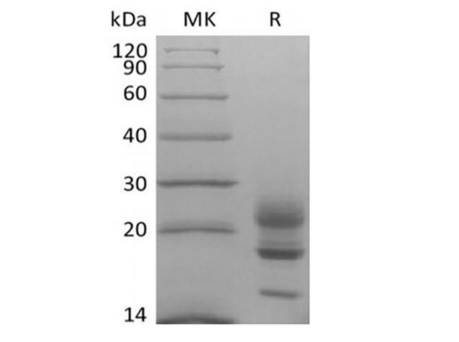 IL17A Protein - Recombinant Cynomolgus Interleukin-17A/IL-17A (C-6His)