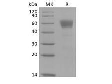 IL3RA / CD123 Protein - Recombinant Cynomolgus IL-3 Receptor Subunit Alpha/IL-3RA/CD123 (C-Fc)