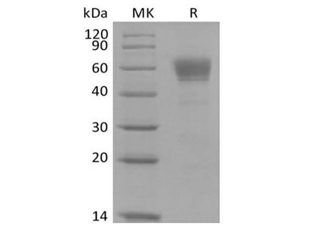 IL3RA / CD123 Protein - Recombinant Cynomolgus IL-3 Receptor Subunit Alpha/IL-3RA/CD123 (C-Fc)