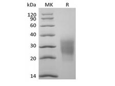KLRK1 / CD314 / NKG2D Protein - Recombinant Cynomolgus NKG2-D type II Integral Membrane Protein/NKG2D/CD314 (N-6His)