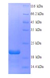 EPO / Erythropoietin Protein