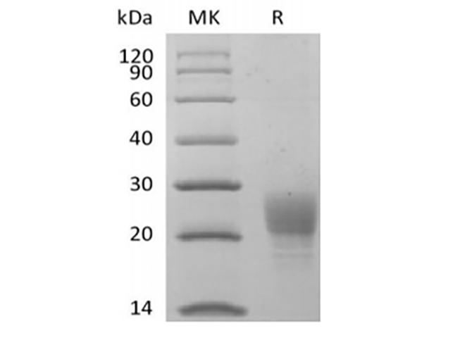 PVRIG Protein - Recombinant Cynomolgus PVRIG (C-6His)