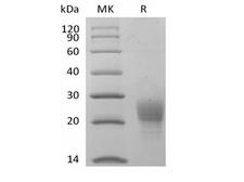 PVRIG Protein - Recombinant Cynomolgus PVRIG (C-6His)