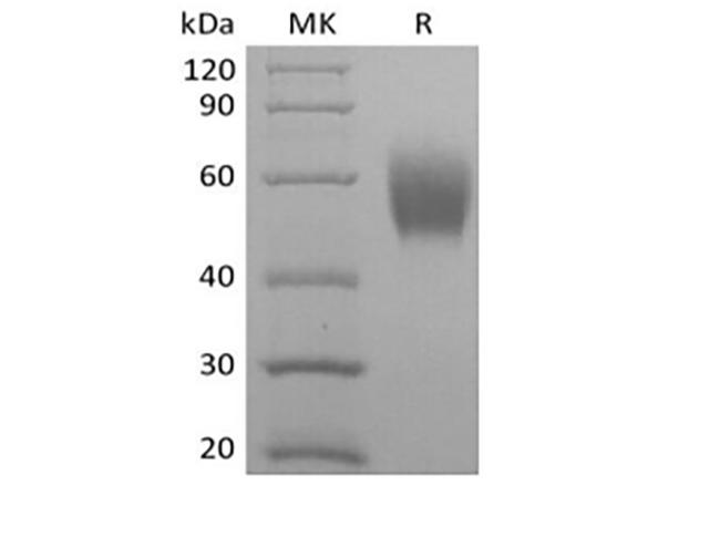 SIRPA / CD172a Protein - Recombinant Cynomolgus Signal-Regulatory Protein alpha-1/SIRPA/CD172a (C-6His)