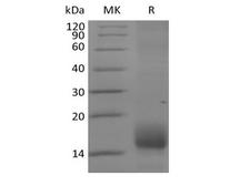 TNFRSF17 / BCMA Protein - Recombinant Cynomolgus BCMA/TNFRSF17 (C-6His)