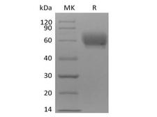TPBG / 5T4 Protein - Recombinant Cynomolgus TPBG/5T4 (C-6His)