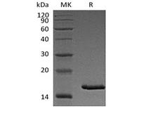 TSLP Protein - Recombinant Cynomolgus Thymic Stromal Lymphopoietin/TSLP (C-6His)