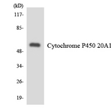 CYP-M / CYP20A1 Antibody - Western blot analysis of the lysates from HUVECcells using Cytochrome P450 20A1 antibody.