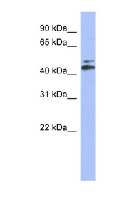 CYP-M / CYP20A1 Antibody - CYP20A1 antibody Western blot of Fetal Lung lysate. This image was taken for the unconjugated form of this product. Other forms have not been tested.