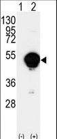 CYP-M / CYP20A1 Antibody - Western blot of CYP20A1(arrow) using rabbit polyclonal CYP20A1 Antibody. 293 cell lysates (2 ug/lane) either nontransfected (Lane 1) or transiently transfected with the CYP20A1 gene (Lane 2) (Origene Technologies).