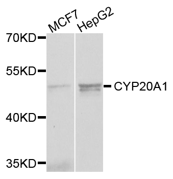 CYP-M / CYP20A1 Antibody - Western blot analysis of extracts of various cells.