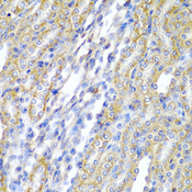 CYP-M / CYP20A1 Antibody - Immunohistochemistry of paraffin-embedded rat kidney tissue.