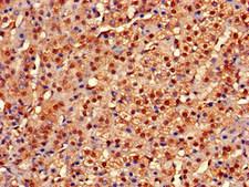 CYP-M / CYP20A1 Antibody - Immunohistochemistry of paraffin-embedded human adrenal gland tissue at dilution of 1:100