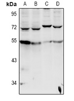 CYP-M / CYP20A1 Antibody - Western blot analysis of Cytochrome P450 20A1 expression in MCF7 (A), HepG2 (B), AML12 (C), PC12 (D) whole cell lysates.