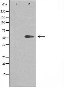 CYP-M / CYP20A1 Antibody - Western blot analysis of extracts of Jurkat cells using Cytochrome P450 20A1 antibody. The lane on the left is treated with the antigen-specific peptide.