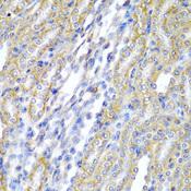 CYP-M / CYP20A1 Antibody - Immunohistochemistry of paraffin-embedded Rat kidney using CYP20A1 Polyclonal Antibody at dilution of 1:200 (40x lens).