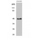 CYP11B1+2 Antibody - Western blot of CYP11B1/2 antibody