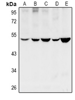CYP11B1+2 Antibody - Western blot analysis of Cytochrome P450 11B1/2 expression in HEK293T (A), LO2 (B), SGC7901 (C), PC12 (D), CT26 (E) whole cell lysates.