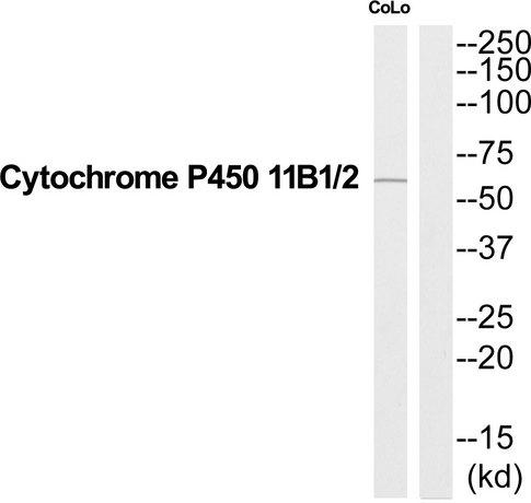 CYP11B1+2 Antibody - Western blot analysis of extracts from COLO205 cells, using Cytochrome P450 11B1/2 antibody.