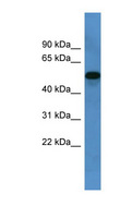 CYP11B1 Antibody - CYP11B1 antibody Western blot of Fetal Liver lysate.  This image was taken for the unconjugated form of this product. Other forms have not been tested.