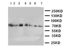 CYP11B1 Antibody - WB of CYP11B1 antibody. Lane 1: HELA Cell Lysate. Lane 2: U87 Cell Lysate. Lane 3: M231 Cell Lysate. Lane 4: PANC Cell Lysate. Lane 5: M453 Cell Lysate. Lane 6: HELA Cell Lysate. Lane 7: SMMC Cell Lysate.
