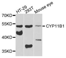 CYP11B1 Antibody - Western blot analysis of extracts of various cells.