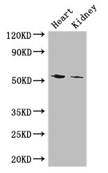 CYP11B1 Antibody - Positive WB detected in:Mouse heart tissue,Mouse kidney tissue;All lanes: CYP11B1 antibody at 3ug/ml;Secondary;Goat polyclonal to rabbit IgG at 1/50000 dilution;Predicted band size: 58,50 kDa;Observed band size: 58 kDa;