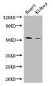 CYP11B1 Antibody - Positive WB detected in:Mouse heart tissue,Mouse kidney tissue;All lanes: CYP11B1 antibody at 3ug/ml;Secondary;Goat polyclonal to rabbit IgG at 1/50000 dilution;Predicted band size: 58,50 kDa;Observed band size: 58 kDa;